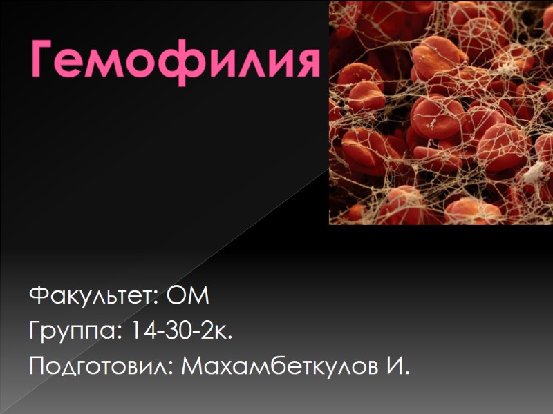 Гемофилия Факультет: ОМ Группа: 14-30-2к. Подготовил: Махамбеткулов И.